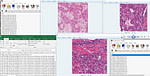 دیتاست تصاویر پزشکی برای تقسیم هسته سلولی Medical Images for Nucleus Segmentation